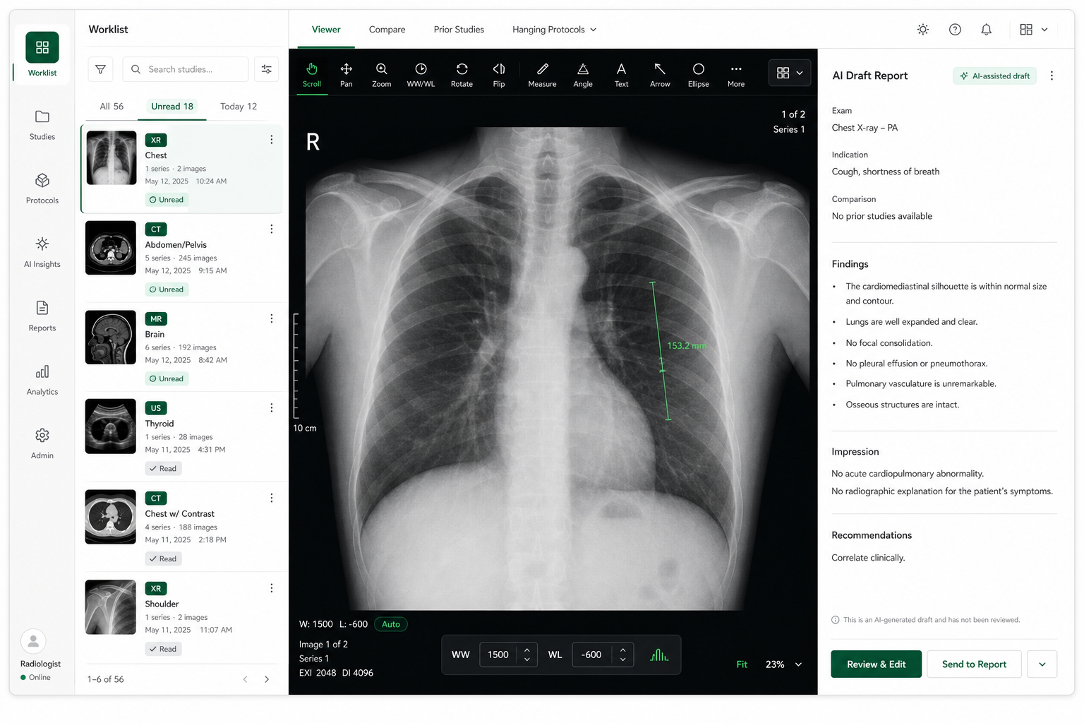 Alcura Radiology DICOM viewer with modality worklist and AI-drafted report